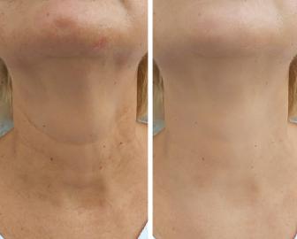 Shoppers Have Officially Found an Anti-Aging Neck Serum That 'Actually Works'