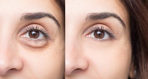 This Eye Cream Gives You a Luxurious 2-in-1 Experience