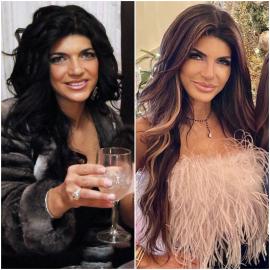 Teresa Giudice Quotes on Plastic Surgery After Melissa's Forehead Claims