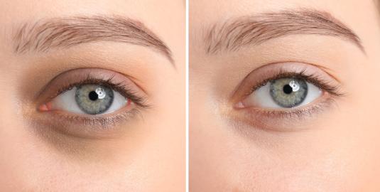 This Light and Gentle Eye Gel Is a Bestselling Antidote for Dark Circles