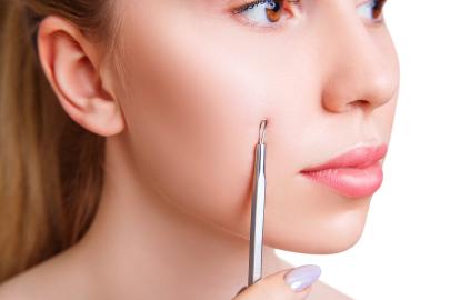 Pimples: Popped! This Professional-Grade Extractor Set Is $16 on Amazon