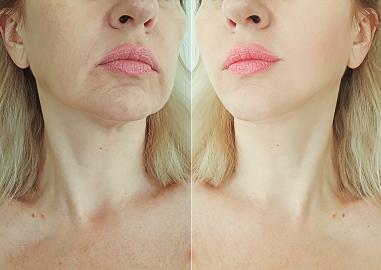 This Anti-Aging Neck Cream Is Sagging Skin’s Worst Nightmare 