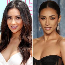 Has Shay Mitchell Had Plastic Surgery? See Her ​Before and After Photos