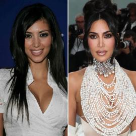 Kim Reveals Which Body Part Is ‘Botoxed’: See Her Before, After Photos