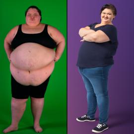 Before and After! 1000-Lb Sisters' Amy Slaton's Weight Loss Journey
