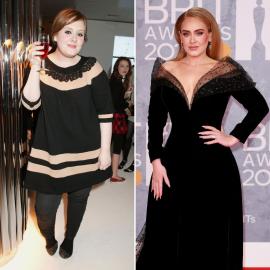 Did Adele Get Plastic Surgery? See Her Transformation Photos