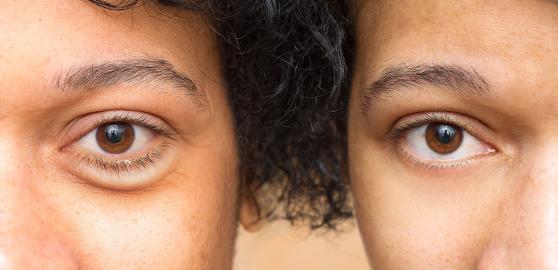 Hi, Bright Eyes! This Rice Water Eye Cream Is on Sale for Under $10