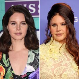 Forever ~Young and Beautiful~? Lana Del Rey's Plastic Surgery Rumors