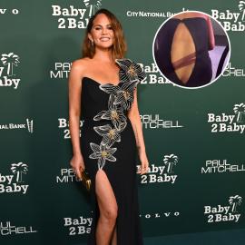Chrissy Teigen Suffers Wardrobe Malfunction at Baby2Baby Gala: Photo