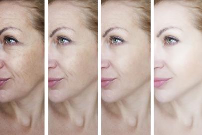 This Fragrance-Free Skincare Kit Fights Wrinkles and Signs of Aging