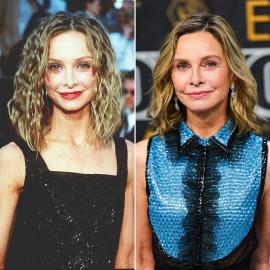 Has Calista Flockhart Had Plastic Surgery? See Her Transformation