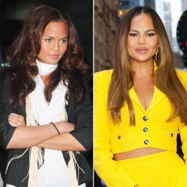 Did Chrissy Teigen Get Plastic Surgery? Before and After Transformation