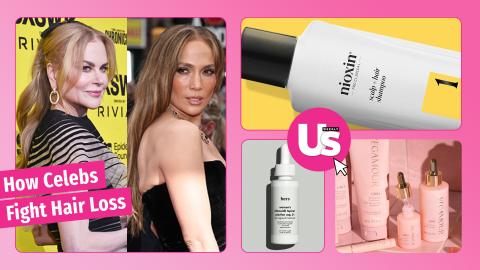 10 Celebrities Facing Hair Loss, and What They Use To Fight It