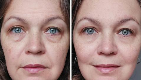 This Skincare System Improves Skin Firmness in 28 Days